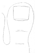 []